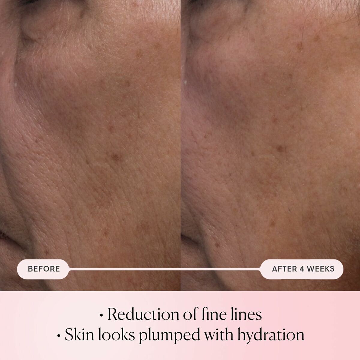 V1HB15B9093DD228DB86DE7B513B8A54589RP2