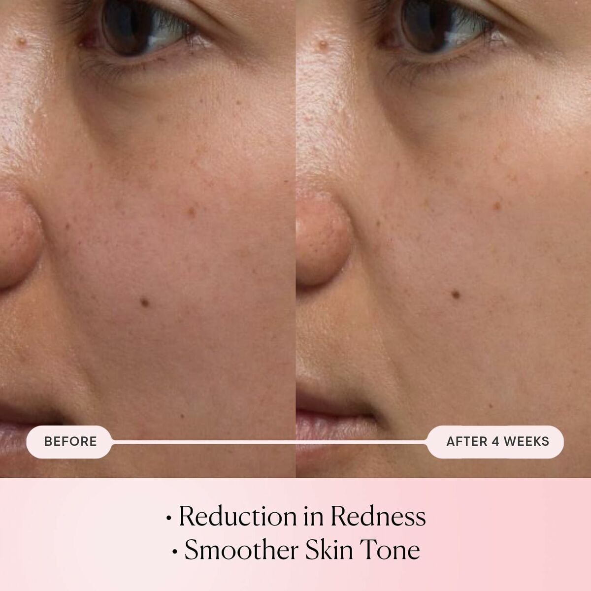 V1HDA86869BDC6B85C1CCA52EAFD0CD9A1DRP3